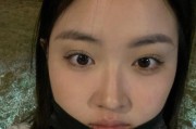 手机拍照眼睛斜了怎么调整？