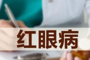 单反相机红眼怎么去掉？有效预防红眼的方法有哪些？