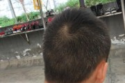 手机拍照出现白色是什么原因？