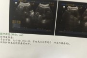小米12背屏内膜破损如何修复？修复过程中需要注意什么？