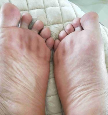 手机如何放置脚底拍照？