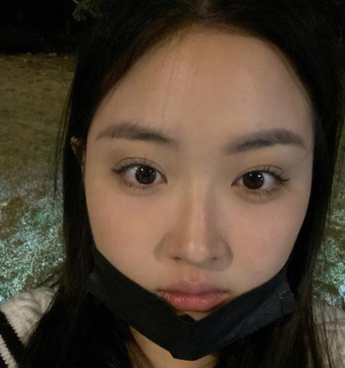 手机拍照眼睛斜了怎么调整？