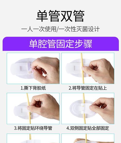 手机拍照固定器安装步骤是什么？安装后拍照效果如何？