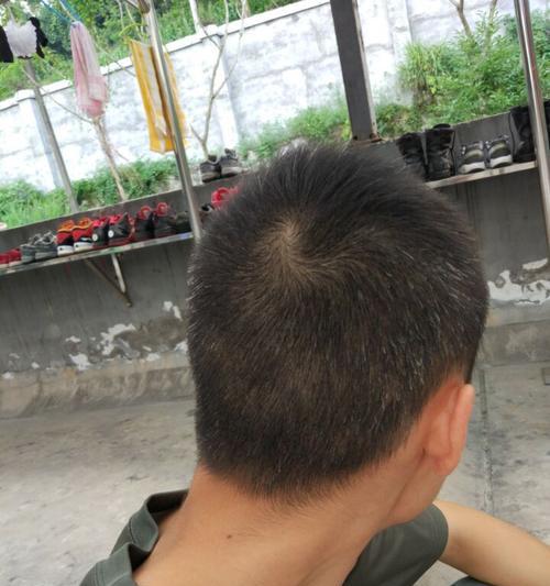 手机拍照出现白色是什么原因？
