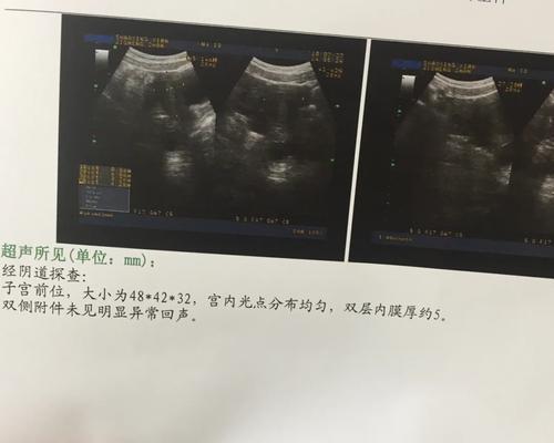 小米12背屏内膜破损如何修复？修复过程中需要注意什么？